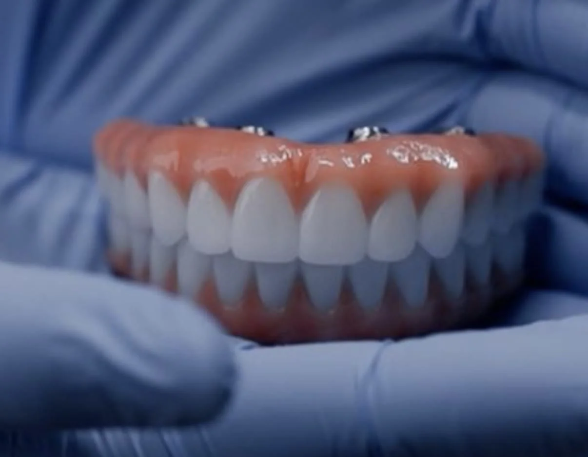 Manos con guantes azules sosteniendo una pr&oacute;tesis dental fija de arcada completa, con las arcadas superior e inferior juntas, dientes blancos, bases rosadas tipo enc&iacute;a y puntos met&aacute;licos de conexi&oacute;n a los implantes en la parte superior