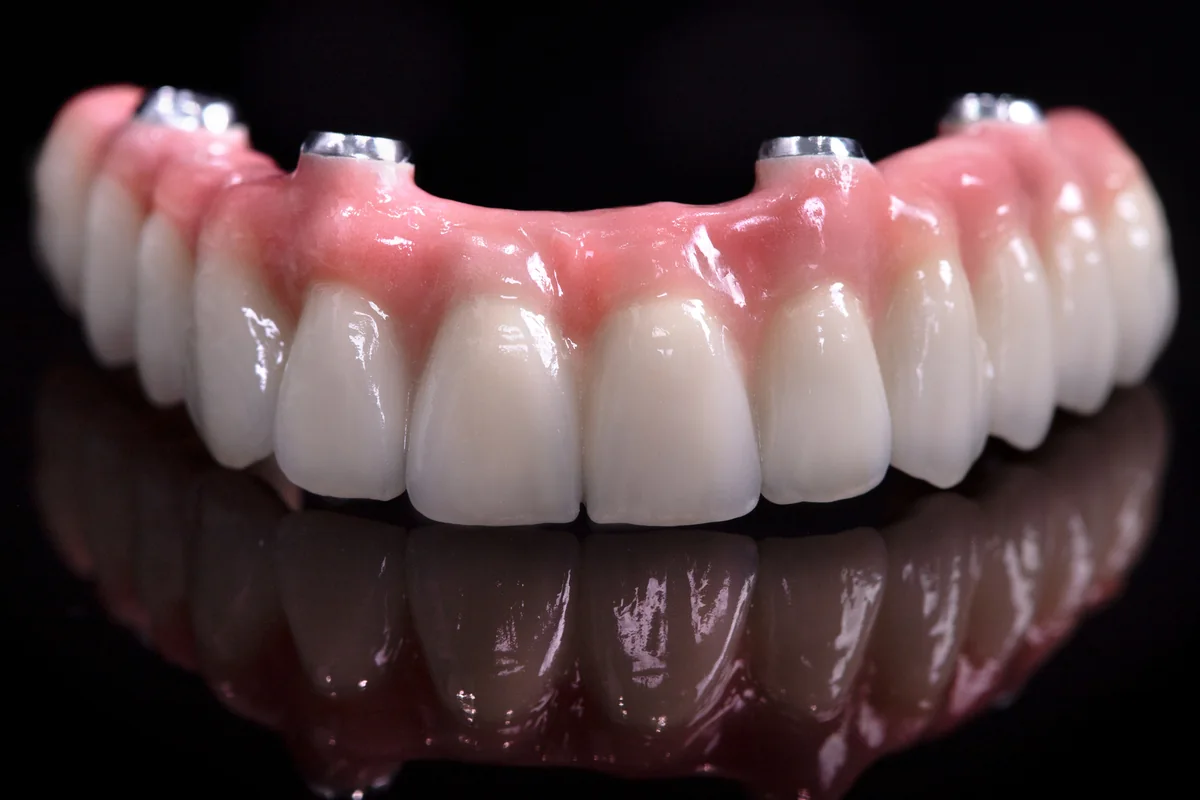 Una pr&oacute;tesis dental fija de arcada completa terminada, vista de frente, con dientes blancos brillantes y una base rosada color enc&iacute;a sobre una superficie negra reflectante