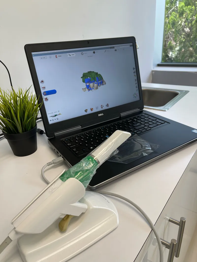 Un esc&aacute;ner intraoral digital port&aacute;til junto a una laptop que muestra un escaneo 3D a color de una arcada dental